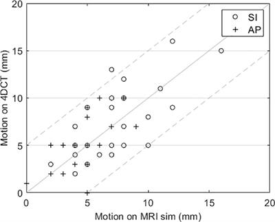 Clinical experience with adaptive MRI-guided pancreatic SBRT and the use of abdominal compression to reduce treatment volume